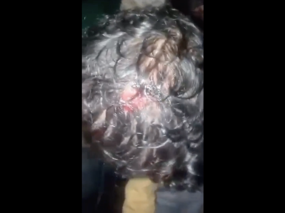 Bίαιο pushback με ξυλοδαρμό προσφύγων κοντά στη Χίο image